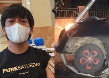 Vokalis Band Rian D’Masiv Alami Kecelakaan Parah