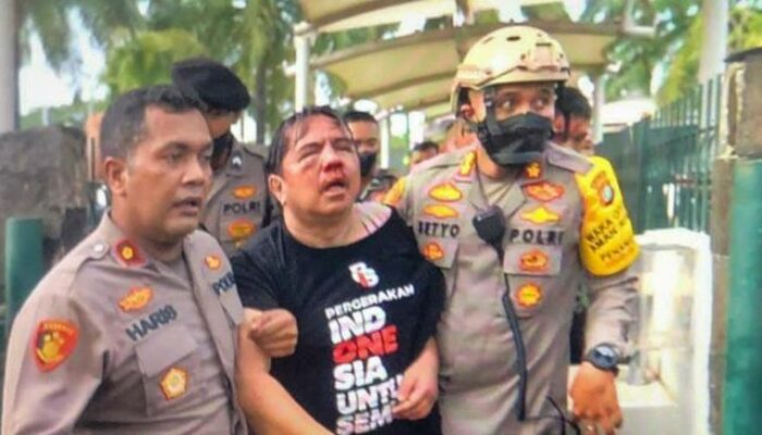 Wajah Ade Armando Babak Belur saat Aksi Demo Mahasiswa di Gedung DPR RI
