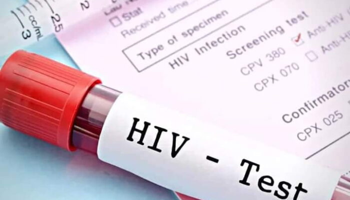 Skrining Darah di Mako Satpol PP Padang: 1 Waria dan Gay Positif HIV, 6 Orang Idap PML