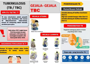Waduh! 747 Orang Terduga TB Terjaring Puskesmas Ambacang Kuranji, Sebagian Besar di Dominasi Anak-anak