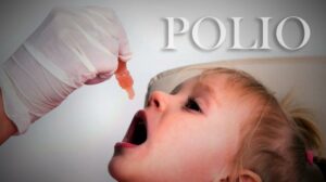 Imunisasi Polio
