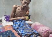 Memprihatinkan! Jal Gusrianto Warga Korong Kampung Pinang Butuh Bantuan, Tiap Hari Kondisinya Menurun