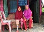 Impian 7 Tahun Susmayeni Miliki Kaki Palsu Terwujud Berkat Baznas Semen Padang