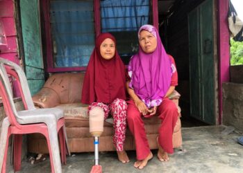 Impian 7 Tahun Susmayeni Miliki Kaki Palsu Terwujud Berkat Baznas Semen Padang