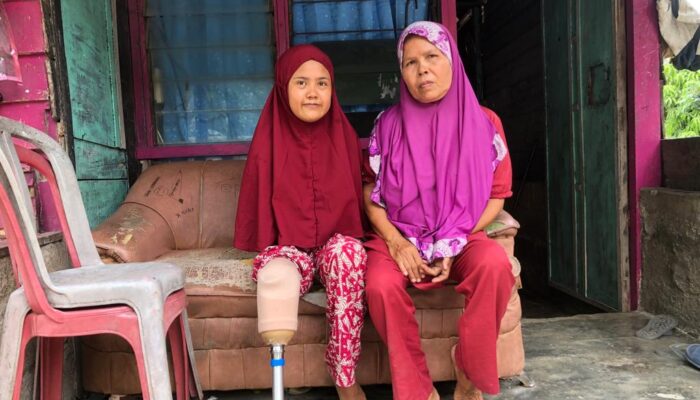 Impian 7 Tahun Susmayeni Miliki Kaki Palsu Terwujud Berkat Baznas Semen Padang