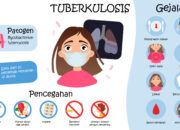 Kepala Puskesmas Ambacang: TBC Itu Penyakit Menular, Bukan Penyakit Kutukan!