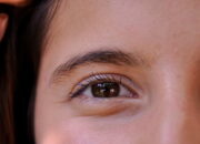 LASIK Mata, Solusi Terbaik untuk Mengatasi Kelainan Refraksi