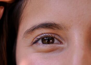 LASIK Mata, Solusi Terbaik untuk Mengatasi Kelainan Refraksi