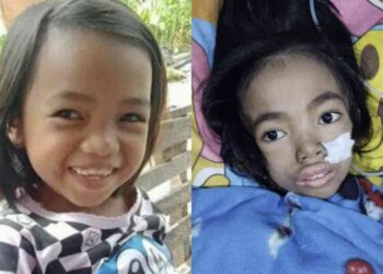 ‘Dibakar’ Teman, Begini Sosok Aldelia Rahma Sebelum Meninggal Dunia