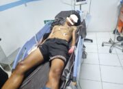 Tawuran Antar Geng di Padang Kian Gila, Tangan Kiri Pemuda Putus Tersabet Sajam