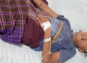 Bocah 10 Tahun di Kampung Dalam Tertembak Senapan Angin di Kepala Saat Bermain