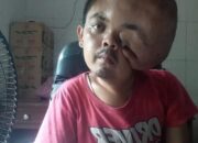 Dinsos Pessel Kunjungi Warga Penderita Tumor di Kampung Duku