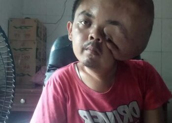 Dinsos Pessel Kunjungi Warga Penderita Tumor di Kampung Duku