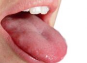 Lidah Terasa Pahit Bisa Jadi Tanda Liver Bermasalah