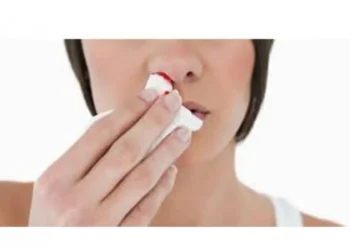 Tips Mencegah Mimisan