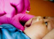 Indonesia Resmi Akhiri KLB Polio Tipe 2