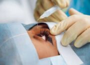 Perawatan Pascaoperasi Katarak: Pantangan dan Aktivitas yang Harus Dihindari