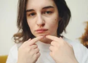 Tips Agar Wajah Bebas dari Jerawat