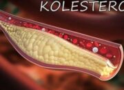 Inilah Beberapa Kebiasaan yang Menyebabkan Kolesterol Tinggi