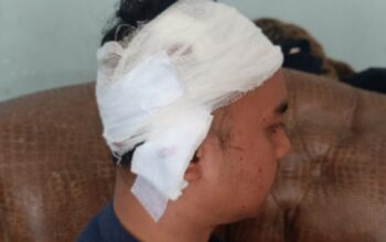Tagih Utang, Pemuda Ibuah Dikeroyok di Ompang Tanah Sirah, Kepala Robek Dapat 28 Jahitan