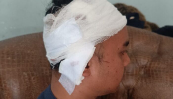 Tagih Utang, Pemuda Ibuah Dikeroyok di Ompang Tanah Sirah, Kepala Robek Dapat 28 Jahitan