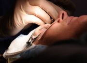 Memahami Prosedur LASIK, Solusi Modern untuk Penglihatan Bebas Kacamata